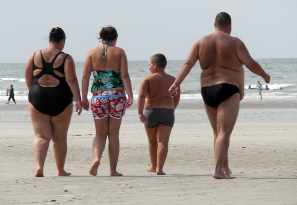 Obesity in France