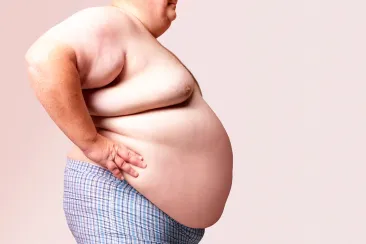 Obesity in Romania